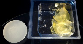 Before and After breast implants - ABC News Before and After breast implants - ABC News